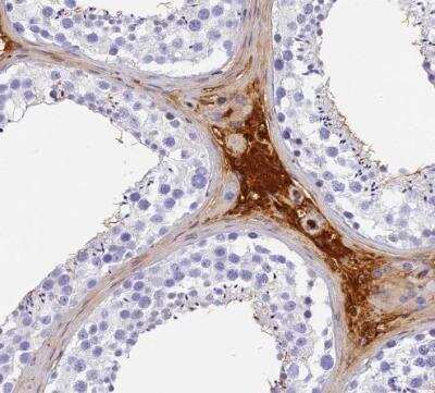 Immunohistochemistry-Paraffin: ITIH1 Antibody [NBP1-81782]