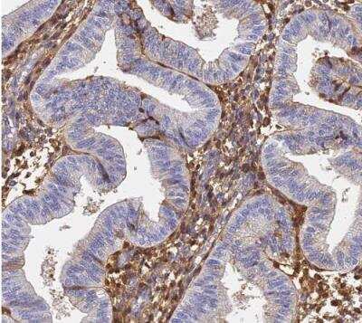 Immunohistochemistry-Paraffin: ITIH1 Antibody [NBP1-81782]