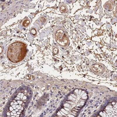 Immunohistochemistry-Paraffin: ITIH1 Antibody [NBP1-81783]