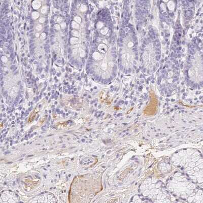 Immunohistochemistry-Paraffin: ITIH2 Antibody [NBP2-31750]