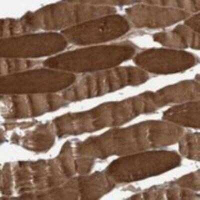 Immunohistochemistry-Paraffin: ITIH3 Antibody [NBP1-93705]