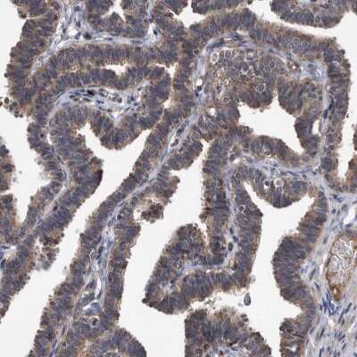 Immunohistochemistry-Paraffin: ITIH3 Antibody [NBP1-93705]
