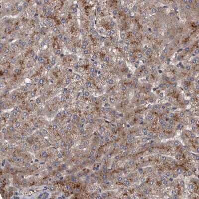 Immunohistochemistry-Paraffin: ITIH3 Antibody [NBP1-93705]