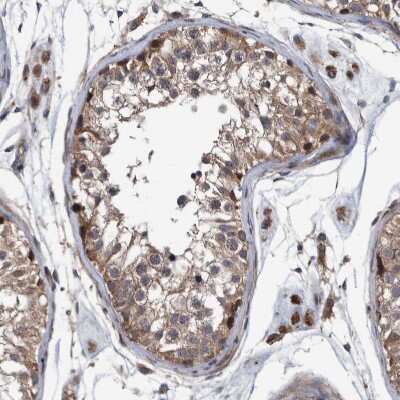 Immunohistochemistry-Paraffin: ITIH3 Antibody [NBP1-93705]