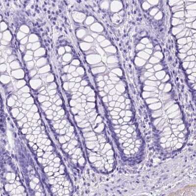 Immunohistochemistry-Paraffin: ITIH4 Antibody [NBP1-81777]