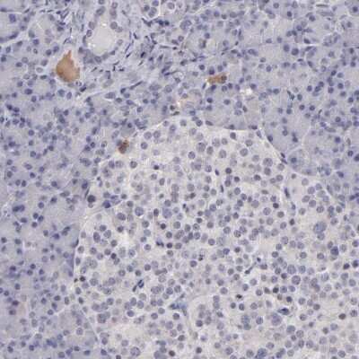 Immunohistochemistry-Paraffin: ITIH4 Antibody [NBP1-81778]
