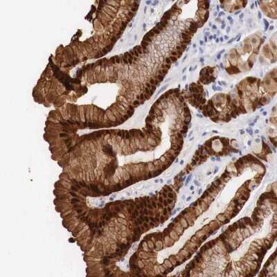 Immunohistochemistry: ITIH5L Antibody [NBP2-34207]