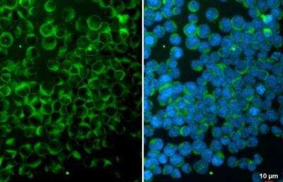 Immunocytochemistry/ Immunofluorescence: ITK Antibody [NBP1-31732]