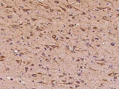 Immunohistochemistry-Paraffin: ITM2A Antibody [NBP2-99451]