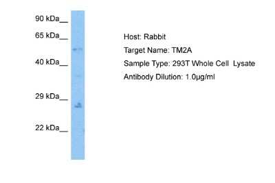 Western Blot: ITM2A Antibody [NBP2-84100]