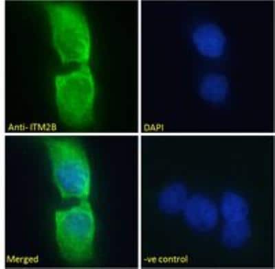 Immunocytochemistry/ Immunofluorescence: ITM2B Antibody [NBP1-36963]