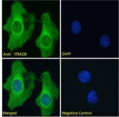 Immunocytochemistry/ Immunofluorescence: ITM2B Antibody [NBP1-36963]