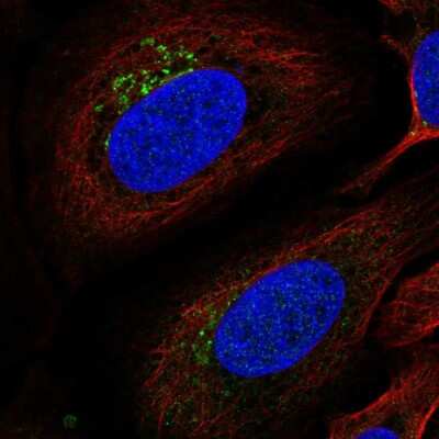 Immunocytochemistry/ Immunofluorescence: ITM2B Antibody [NBP2-57975]