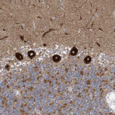 Immunohistochemistry-Paraffin: ITM2B Antibody [NBP1-88354]