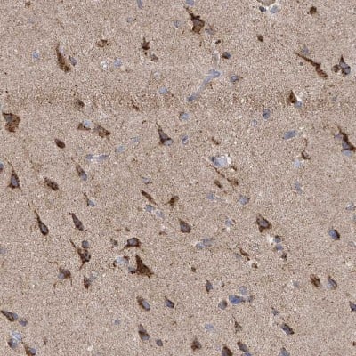 Immunohistochemistry-Paraffin: ITM2B Antibody [NBP1-88354]
