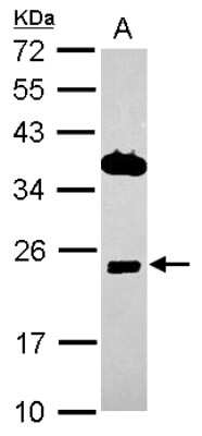 Western Blot: ITM2C Antibody [NBP2-17001]