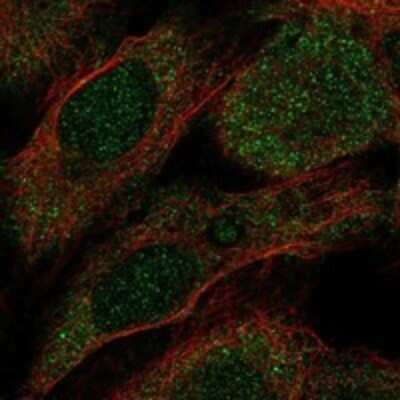 Immunocytochemistry/ Immunofluorescence: ITPA Antibody [NBP3-17266]