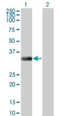 Western Blot: ITPK1 Antibody (2C8) [H00003705-M01]
