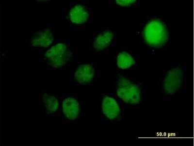 Immunocytochemistry/ Immunofluorescence: ITPK1 Antibody [H00003705-B01P]