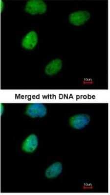 Immunocytochemistry/ Immunofluorescence: ITPK1 Antibody [NBP1-32678]