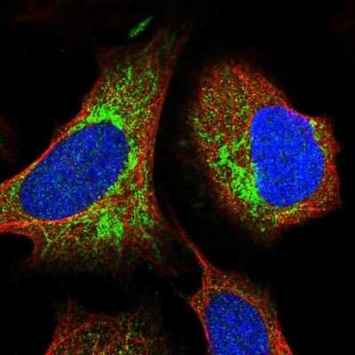 Immunocytochemistry/ Immunofluorescence: ITPK1 Antibody [NBP2-48686]