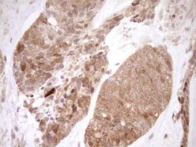 Immunohistochemistry: ITPK1 Antibody (OTI1F5) - Azide and BSA Free [NBP2-71052]