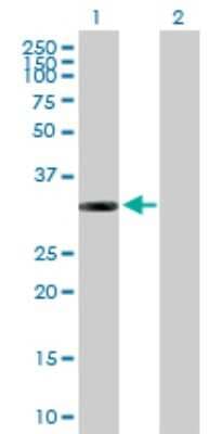 Western Blot: ITPK1 Antibody [H00003705-B01P]