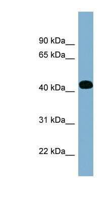 Western Blot: ITPK1 Antibody [NBP1-55389]