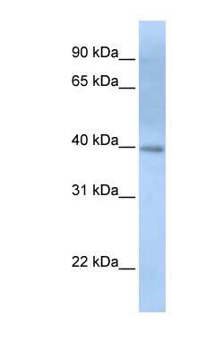 Western Blot: ITPK1 Antibody [NBP1-56619]