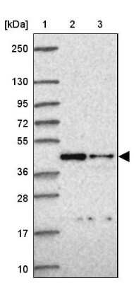Western Blot: ITPK1 Antibody [NBP2-48686]