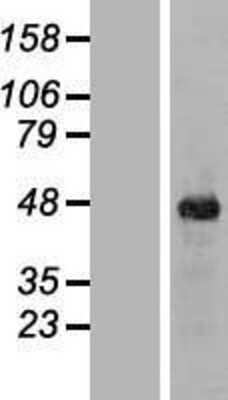 Western Blot: ITPK1 Overexpression Lysate [NBL1-12087]