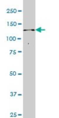 Western Blot: ITPKB Antibody (2F8) [H00003707-M01]