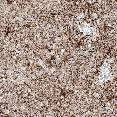 Immunohistochemistry-Paraffin: ITPKB Antibody [NBP1-81589]