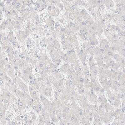 Immunohistochemistry-Paraffin: ITPKB Antibody [NBP1-81589]