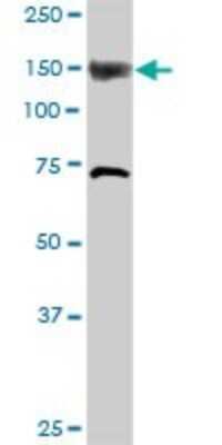 Western Blot: ITPKB Antibody [H00003707-D01P]