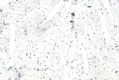 Immunohistochemistry-Paraffin: ITPR2 Antibody [NBP3-12318]