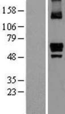 Western Blot: ITPRIP Overexpression Lysate [NBL1-12278]