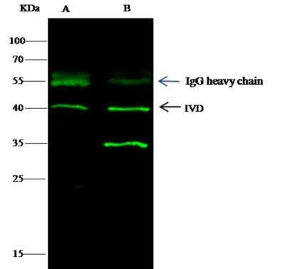 Immunoprecipitation: IVD Antibody (04) [NBP3-06536]