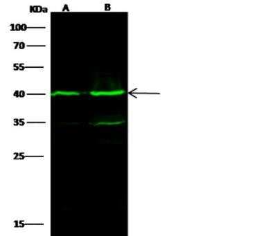 Western Blot: IVD Antibody (04) [NBP3-06536]