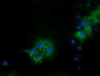 Immunocytochemistry/ Immunofluorescence: IVD Antibody (OTI1B10) [NBP2-03047]