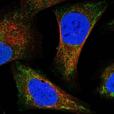 Immunocytochemistry/ Immunofluorescence: IVD Antibody [NBP2-30578]