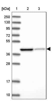 Western Blot: IVD Antibody [NBP2-30578]