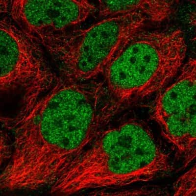 Immunocytochemistry/ Immunofluorescence: IWS1 Antibody [NBP2-49349]