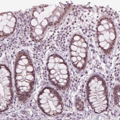 Immunohistochemistry-Paraffin: IWS1 Antibody [NBP2-49349]