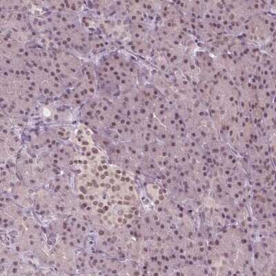 Immunohistochemistry-Paraffin: IWS1 Antibody [NBP2-49349]