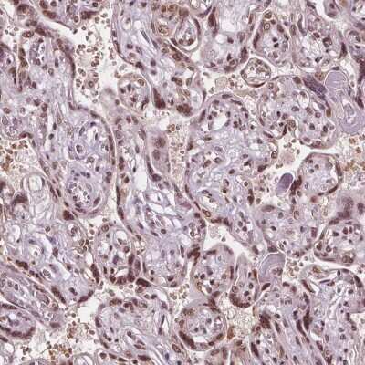 Immunohistochemistry-Paraffin: IWS1 Antibody [NBP2-49349]