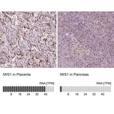 Immunohistochemistry-Paraffin: IWS1 Antibody [NBP2-49349]