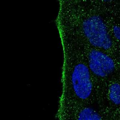 Immunocytochemistry/ Immunofluorescence: IYD Antibody [NBP2-31786]