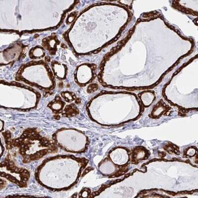 Immunohistochemistry-Paraffin: IYD Antibody [NBP2-31786]