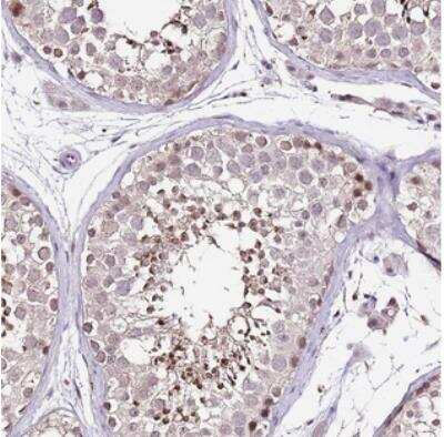 Immunohistochemistry: IZUMO4 Antibody [NBP2-30881]